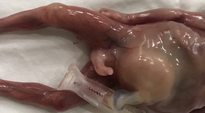 PHOTO AFTER BIRTH 1.jpg
