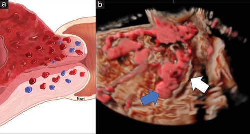 Obs Scan Obstetrics scanning beyond the fetus