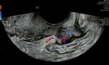 Picture1.jpg 16