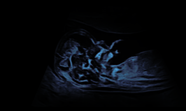 ue2026 website thumbnail v2 300x250.png