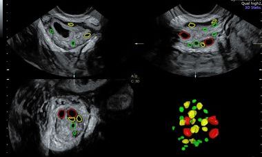 Ultrasound and fertility course image.jpg
