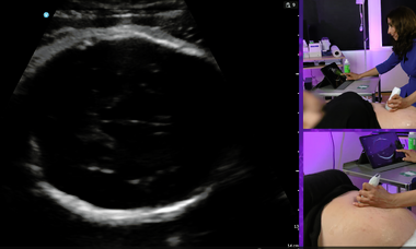 PoCUS course image.png