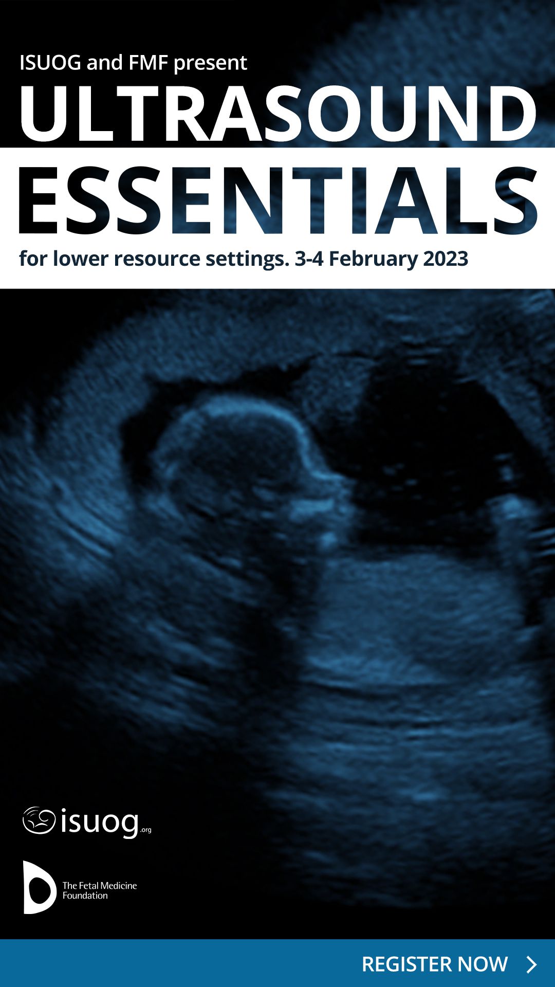 Ultrasound Essentials 2023 Facebook Stories 1080x1920