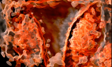 GYN image.png