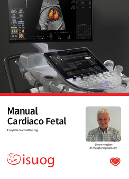 Fetal cardiac handbook (spanish updated 2026)