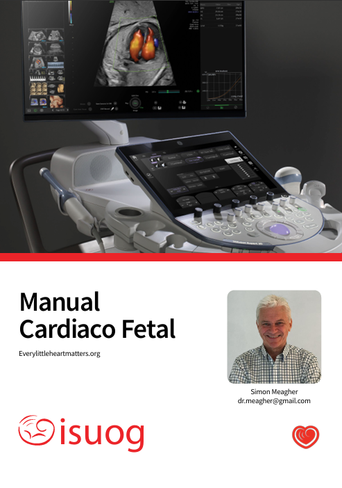 Fetal Cardiac Handbook