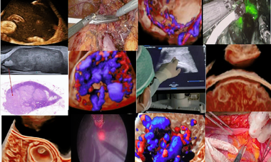 Interventional ultrasound course image.png