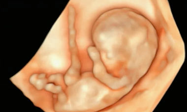 Early pregnancy course image.png