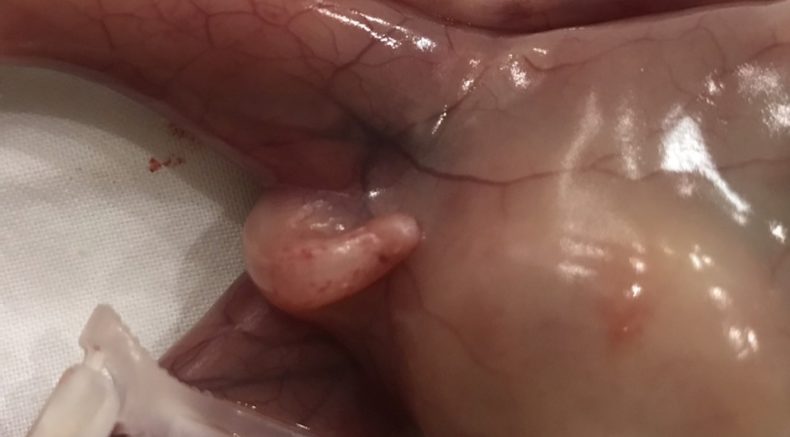 PHOTO AFTER BIRTH 2.jpg
