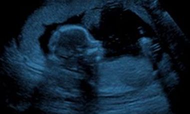 Website_thumbnail_300x250_UE2023.jpg