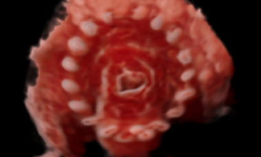 Pessary.png 1