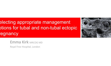 Ectopic pregnancy: selecting appropriate management options for tubal and non-tubal ectopic pregnancy