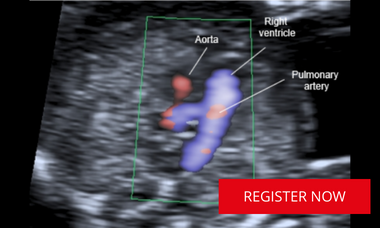 Scan image of fetal heart with register now text 