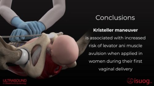 Fundal Pressure