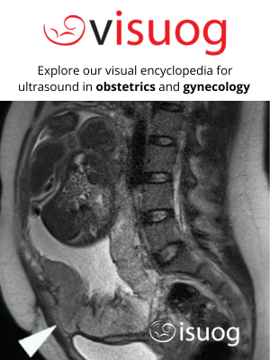 VISUOG encyclopaedia for ultrasound in OBGYN