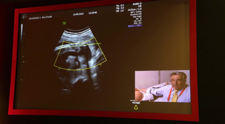 Abstracts of the 32nd World Congress on Ultrasound in Obstetrics and Gynecology, 16–18 September 2022, London, UK & Virtual: Ultrasound in Obstetrics & Gynecology: Vol 60, No S1