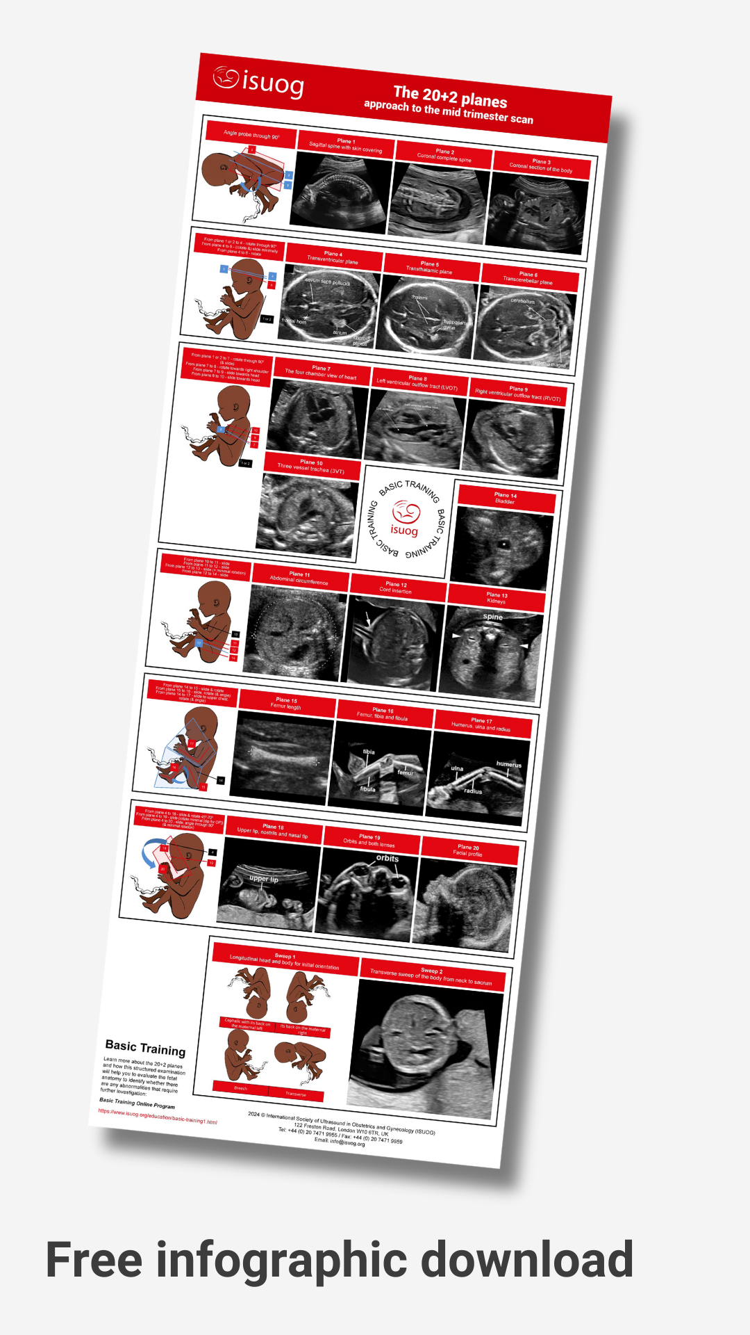 ISUOG 20_2 planes approach study guide 