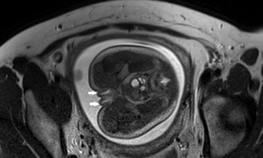 normal female genitalia