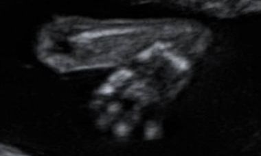 Picture1.jpg 10