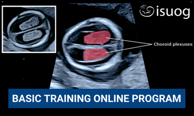 isuog-basic-training-online-program.png