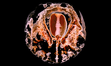 Fteal brain course image.png
