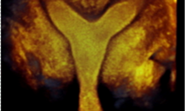 Webinar banner.png