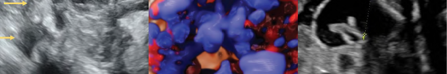 VISUOG.png 3