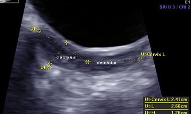 Infertility.jpg