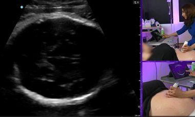 POCUS banner.jpg 2