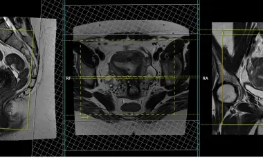 MRI course image.webp