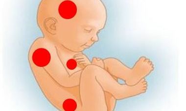 VISUOG baby w dots.jpg