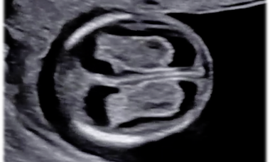 fetal-brain.png