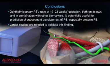 Ophthalmic artery video abstract.png