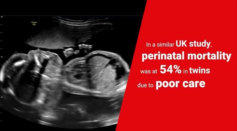 Topic in Spotlight - Twin and Multiple Pregnancy.jpg