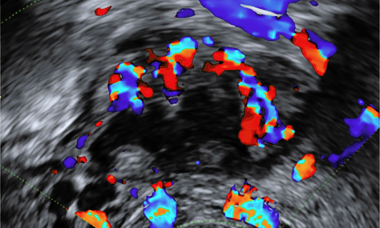 Pelvic-pain-and-endometriosis.png 3