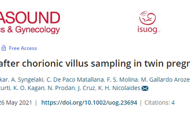 Fetal loss after chorionic villus sampling in twin pregnancy