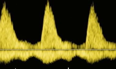 Abnormal Beats.jpg 1