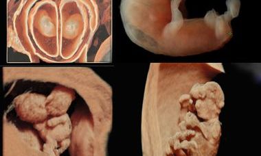 Fetal malformations course picture.jpg