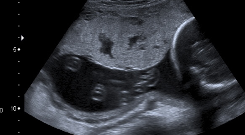 Placental lakes main pic.png