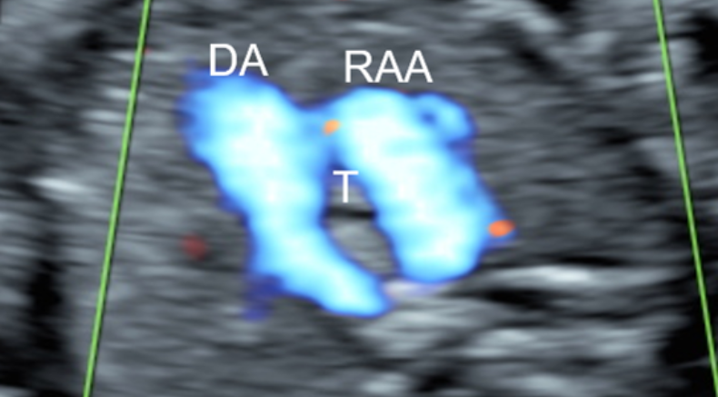 RAA main pic.png