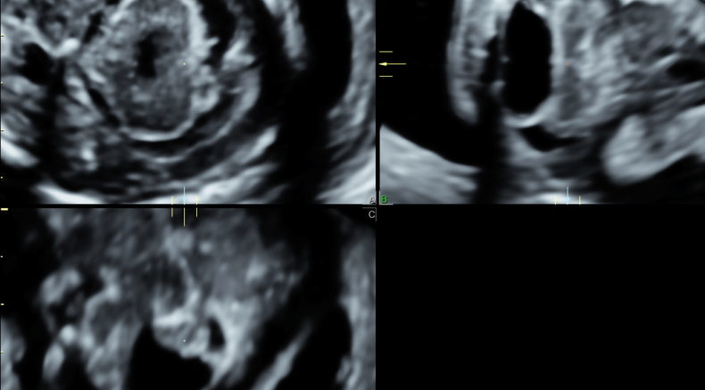 16w Normal Cerebellum.jpg