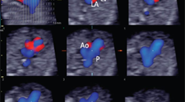 Cardiac exam w STIC.jpg Fetal anomalies 2017