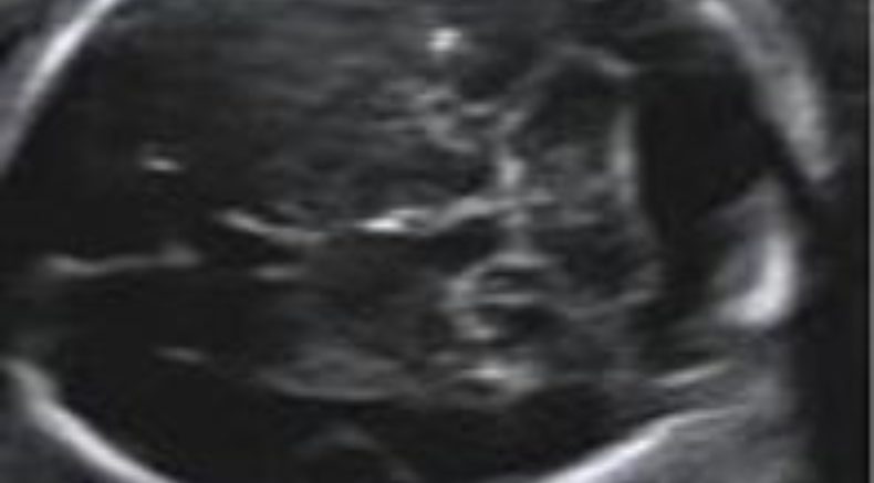Megacisterna magna main pic.JPG