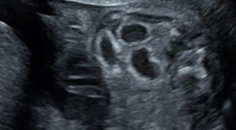 cover photo.jpg 1