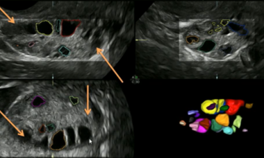 supplement_reading_reproductive_medicine_18.png