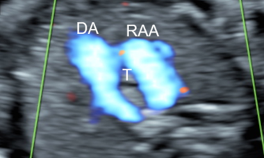 RAA main pic.png