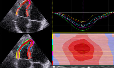 Hemodynamics collage