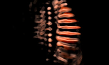 CrystalVue fetal spine