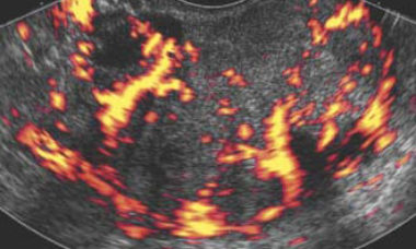 imaging in gyne virtual issue.jpg