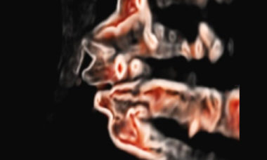 CrystalVue fetal facial profile